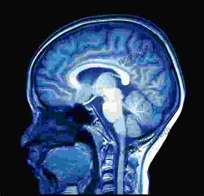 MRI Scan Of The Human Brain Showing Activity Patterns Associated With Decision Making Free Will Sam Harris